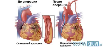 Результат