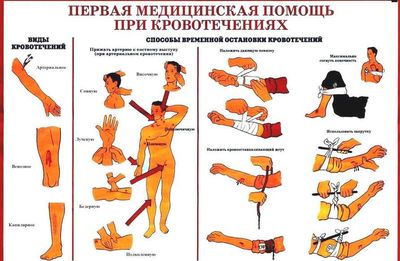 Кровоостанавливающие методы