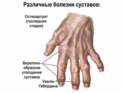 Схематический рисунок