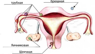 мазня вместо месячных