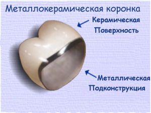структура коронки
