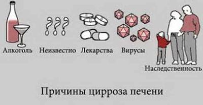 причины цырроза