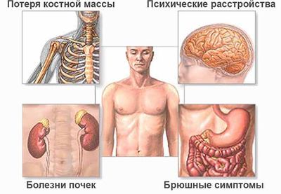 Клиническая картина гиперпаратириоза