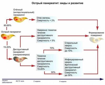 острый панкреатит