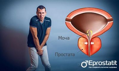 у мужчины боль в простате