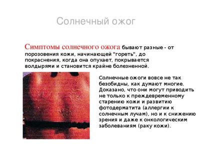 Ожог от солнца