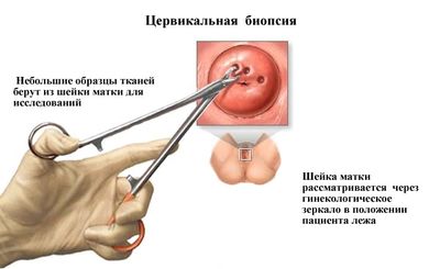 Методы диагностики