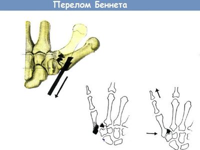 Схематический рисунок