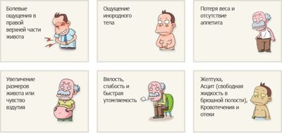 Симптомы рака печени