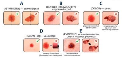 Акорд