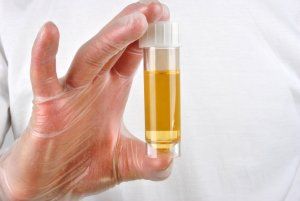 Правильная подготовка к анализу мочи – залог достоверного результата!