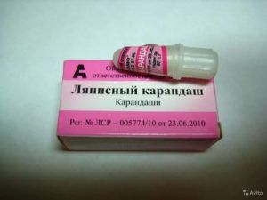Как свести папилломы: эффективные фармацевтические и народные средства