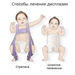 Методы лечения дисплазия