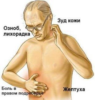 Проявление гепатита